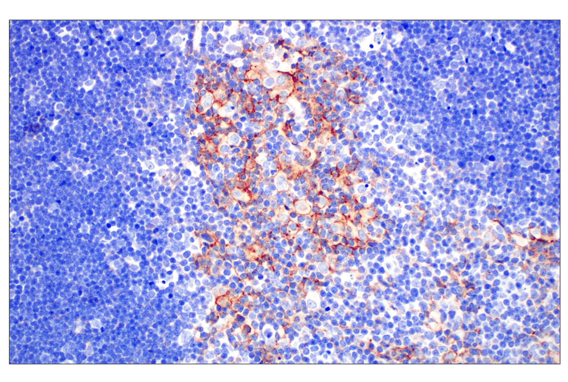 Immunohistochemistry Image 6: EpCAM (D9S3P) Rabbit Monoclonal Antibody (BSA and Azide Free)