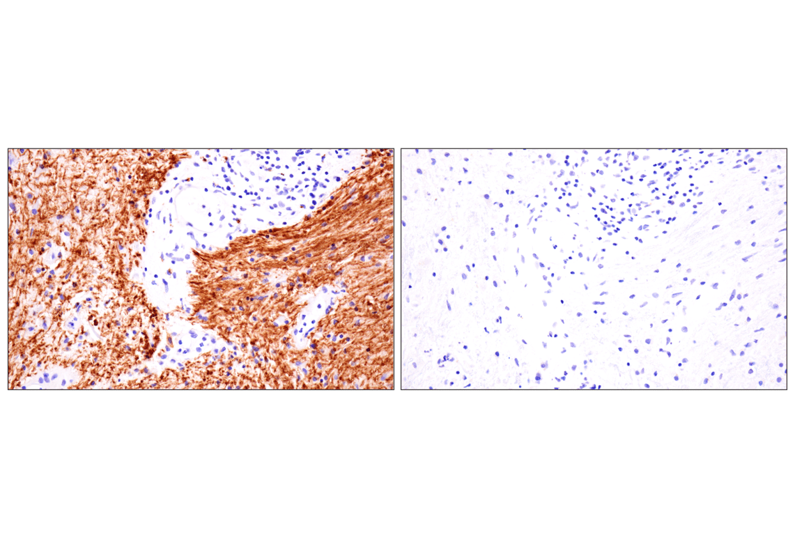 Immunohistochemistry Image 6: PLP1 (E9V1N) Rabbit Monoclonal Antibody