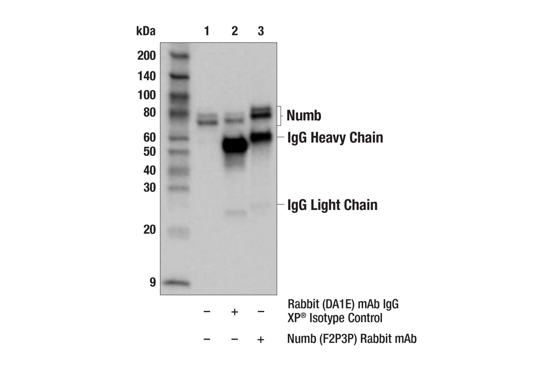 Immunoprecipitation Image 1: Numb (F2P3P) Rabbit Monoclonal Antibody