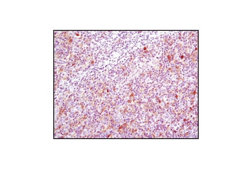 Immunohistochemistry Image 2: GSTP1 (3F2) Mouse Monoclonal Antibody (BSA and Azide Free)