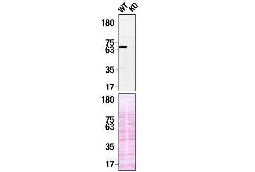 Western Blotting Image 2: Syk (D3Z1E) Rabbit Monoclonal Antibody (Biotinylated)