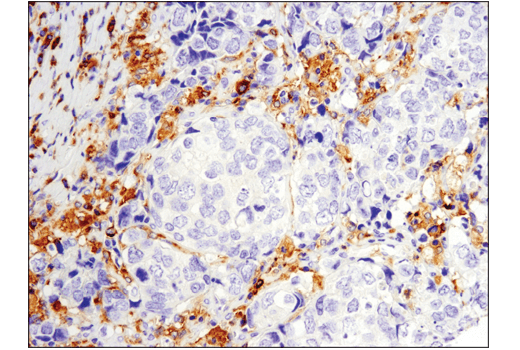 undefined Image 3: PhosphoPlus<sup>®</sup> Btk (Tyr223) Antibody Duet
