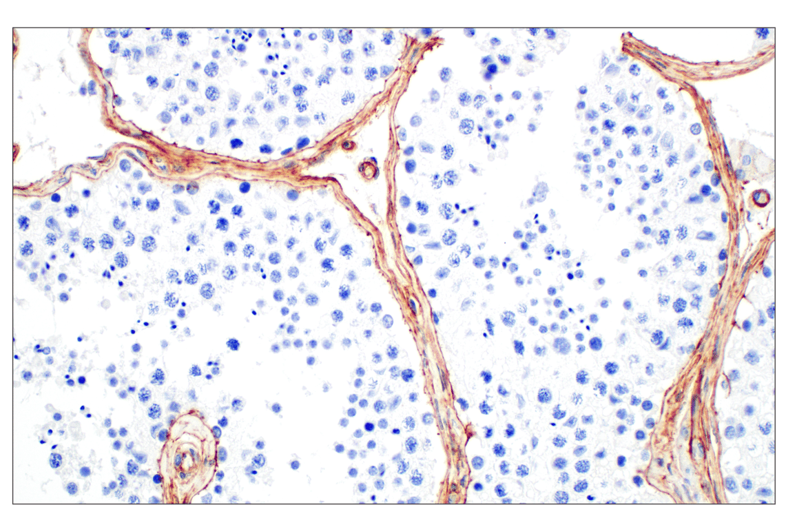 Immunohistochemistry Image 7: COL4A1 (E5M6R) Rabbit Monoclonal Antibody (BSA and Azide Free)