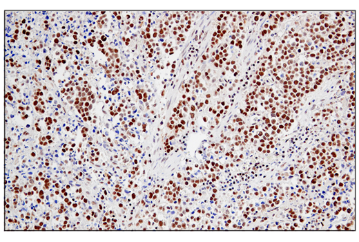 Immunohistochemistry Image 6: JMJD6 (D3O3N) Rabbit Monoclonal Antibody