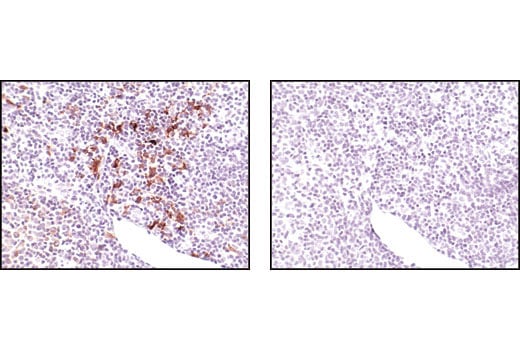Immunohistochemistry Image 1: TRAF1 (45D3) Rabbit Monoclonal Antibody (BSA and Azide Free)
