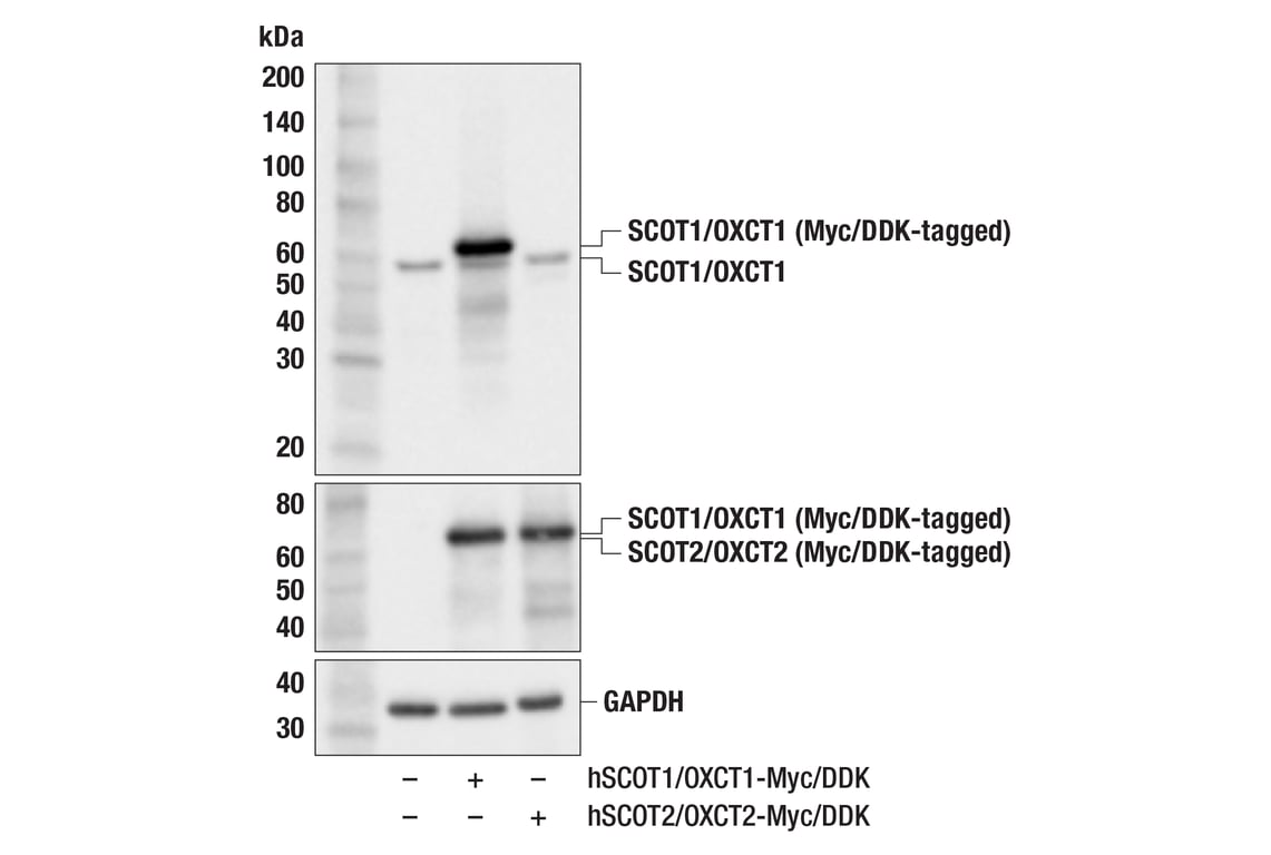 Western Blotting Image 3: SCOT1/OXCT1 (F1O1D) Rabbit Monoclonal Antibody