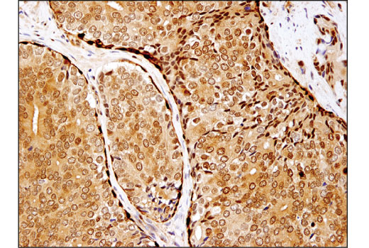 Immunohistochemistry Image 4: HSP70 (D1M6J) Mouse Monoclonal Antibody