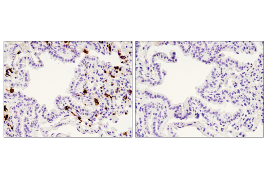 Immunohistochemistry Image 4: CD45 (D3F8Q) Rabbit Monoclonal Antibody (BSA and Azide Free)