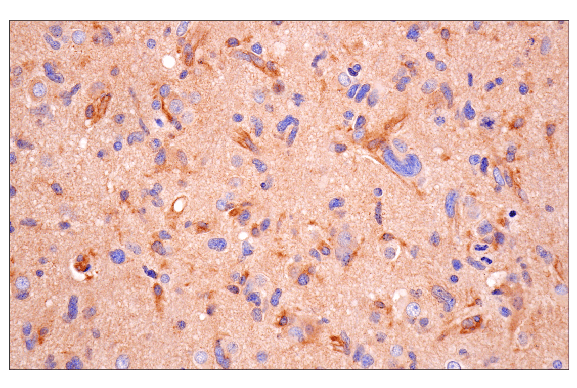 Immunohistochemistry Image 1: Numb (F2P3P) Rabbit Monoclonal Antibody