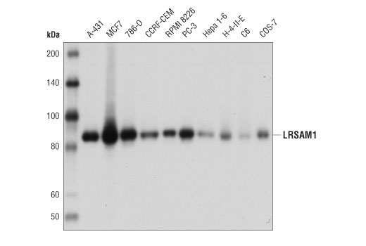 undefined Image 1: Xenophagy Antibody Sampler Kit