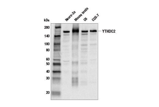 undefined Image 18: N6-Methyladenosine (m6A) Binding Protein Antibody Sampler Kit