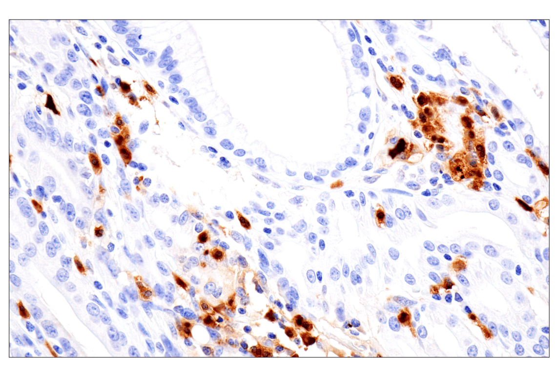 Immunohistochemistry Image 2: S100A8 (F4R2W) Rabbit Monoclonal Antibody