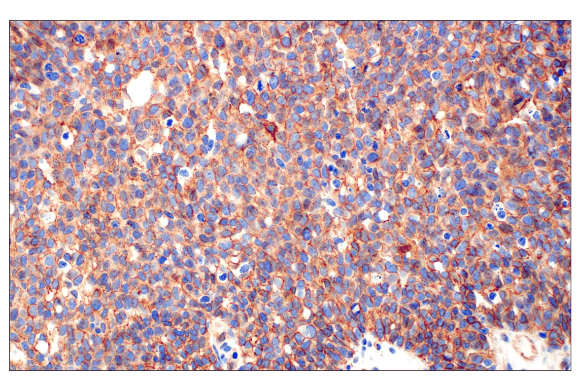 Immunohistochemistry Image 3: beta-Catenin (D10A8) Rabbit Monoclonal Antibody