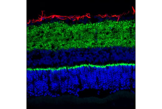 Immunofluorescence Image 1: VAMP2 (D6O1A) Rabbit Monoclonal Antibody