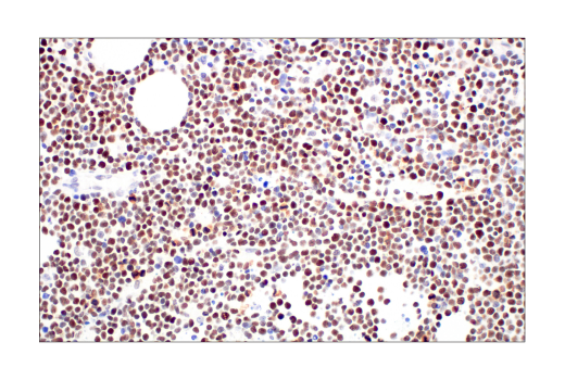 Immunohistochemistry Image 4: Rb (4H1) Mouse Monoclonal Antibody (BSA and Azide Free)