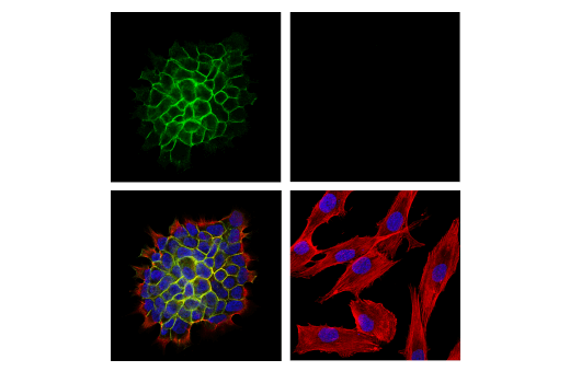 Immunofluorescence Image 1: PTPRF/LAR (E6W4X) Rabbit Monoclonal Antibody