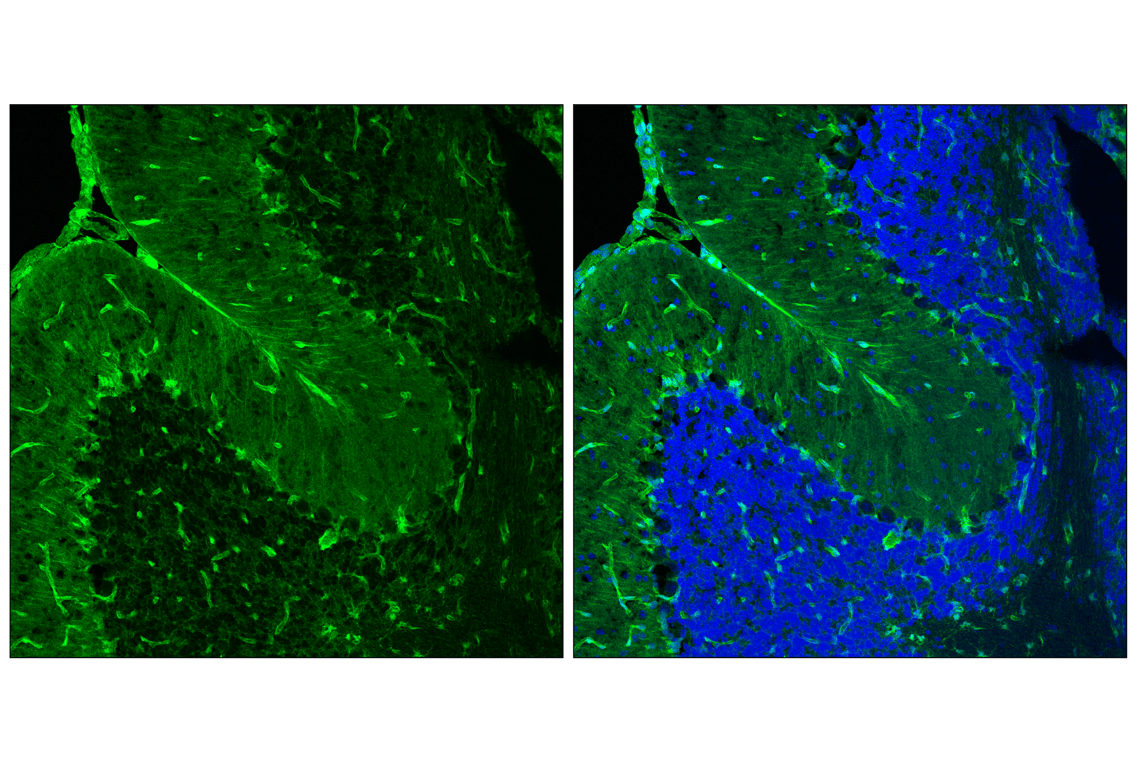 Immunofluorescence Image 3: YAP (D8H1X) XP<sup>®</sup> Rabbit mAb