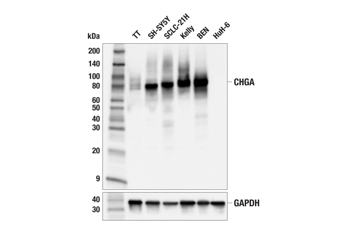 Western Blotting Image 1: CHGA (F7D6H) Rabbit mAb