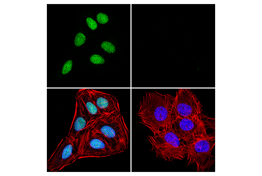 Immunofluorescence Image 1: FANCD2 (D5L5X) Rabbit Monoclonal Antibody