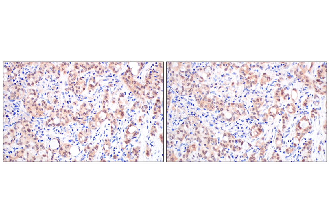 Immunohistochemistry Image 7: BLVRA (F7Z7R) Rabbit Monoclonal Antibody
