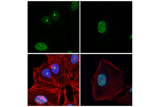 Immunofluorescence Image 2: 53BP1 (E7N5D) Rabbit Monoclonal Antibody (BSA and Azide Free)