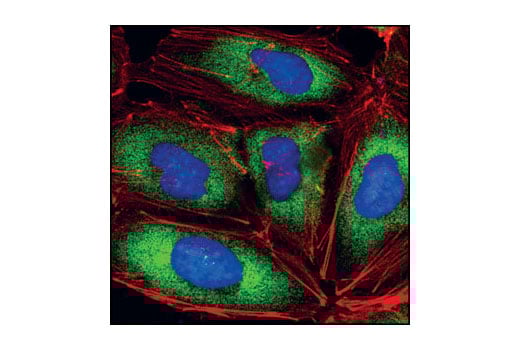 Immunofluorescence Image 1: eIF4G (C45A4) Rabbit Monoclonal Antibody