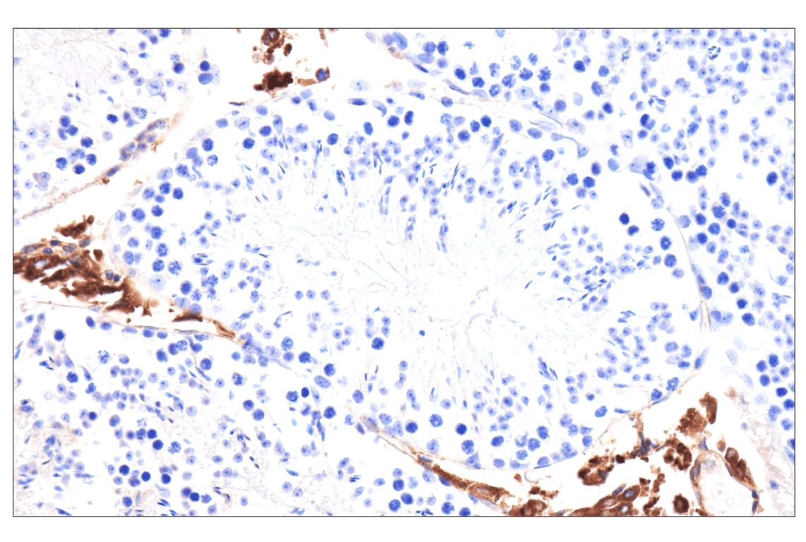 Immunohistochemistry Image 8: SCARB1 (E9H4F) Rabbit Monoclonal Antibody