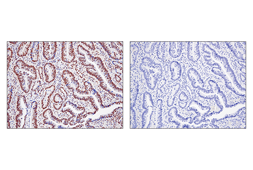 Immunohistochemistry Image 1: SS18 (D6I4Z) Rabbit Monoclonal Antibody (BSA and Azide Free)