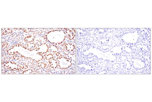 Immunohistochemistry Image 6: SETD2 (E4W8Q) Rabbit Monoclonal Antibody (IHC Formulated)