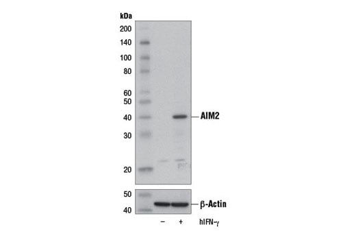 undefined Image 12: Human Reactive Inflammasome Antibody Sampler Kit II
