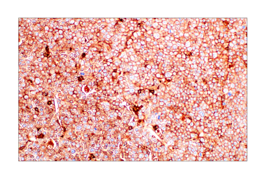 Immunohistochemistry Image 2: Integrin beta2 (E9O7W) Rabbit Monoclonal Antibody