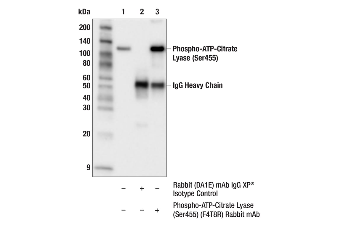 Immunoprecipitation Image 1: Phospho-ATP-Citrate Lyase (Ser455) (F4T8R) Rabbit Monoclonal Antibody