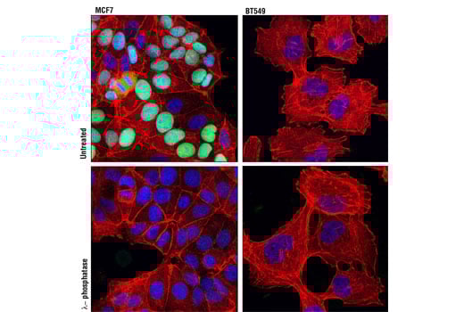 undefined Image 24: Rb Antibody Sampler Kit