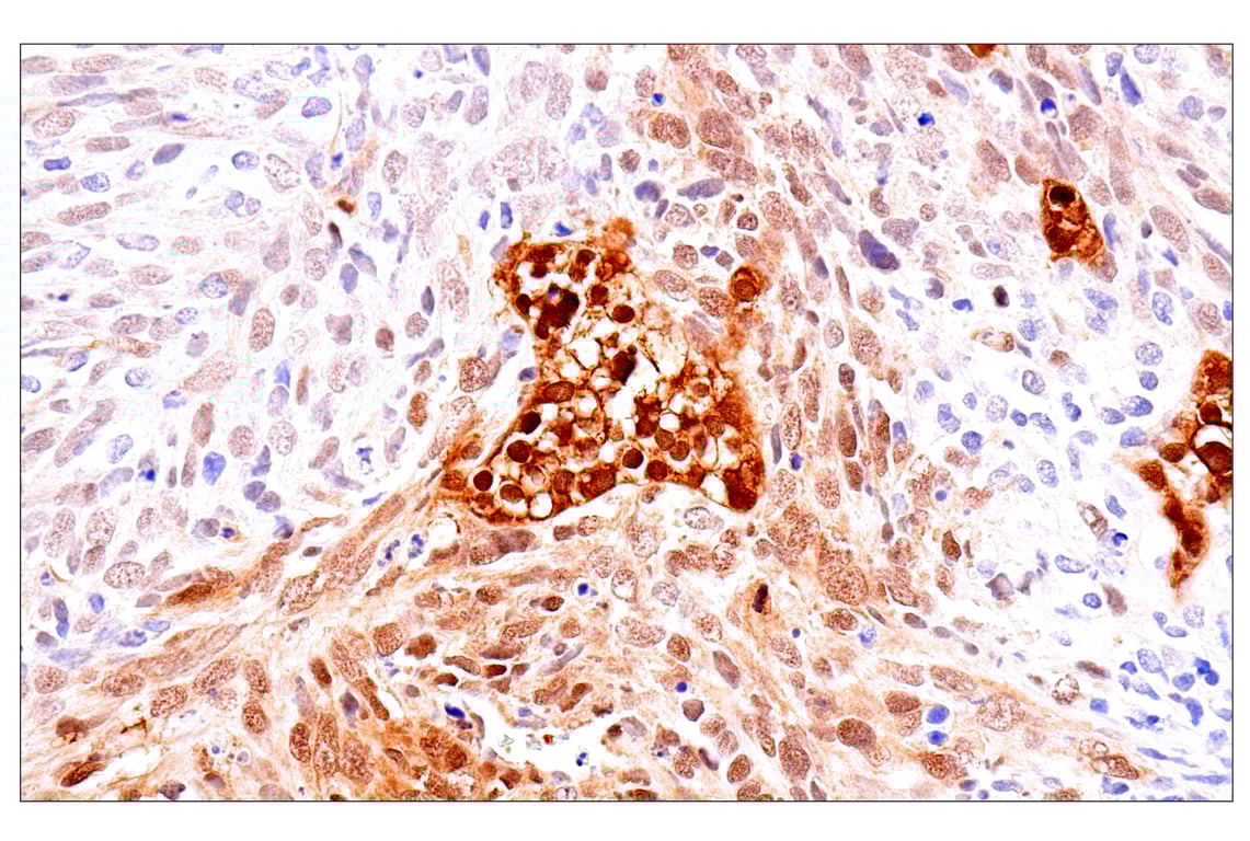 Immunohistochemistry Image 6: Phospho-YAP (Ser61) (E4Q8S) Rabbit Monoclonal Antibody