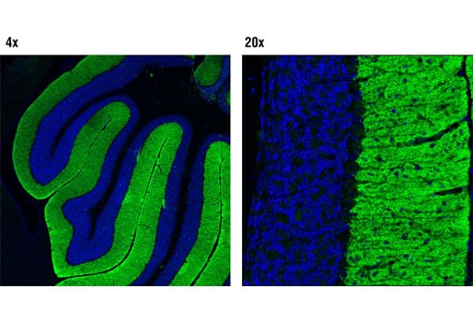 undefined Image 19: Fragile X/FMRP Signaling Pathway Antibody Sampler Kit