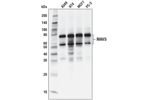 Western Blotting Image 2: MAVS (D5A9E) Rabbit Monoclonal Antibody
