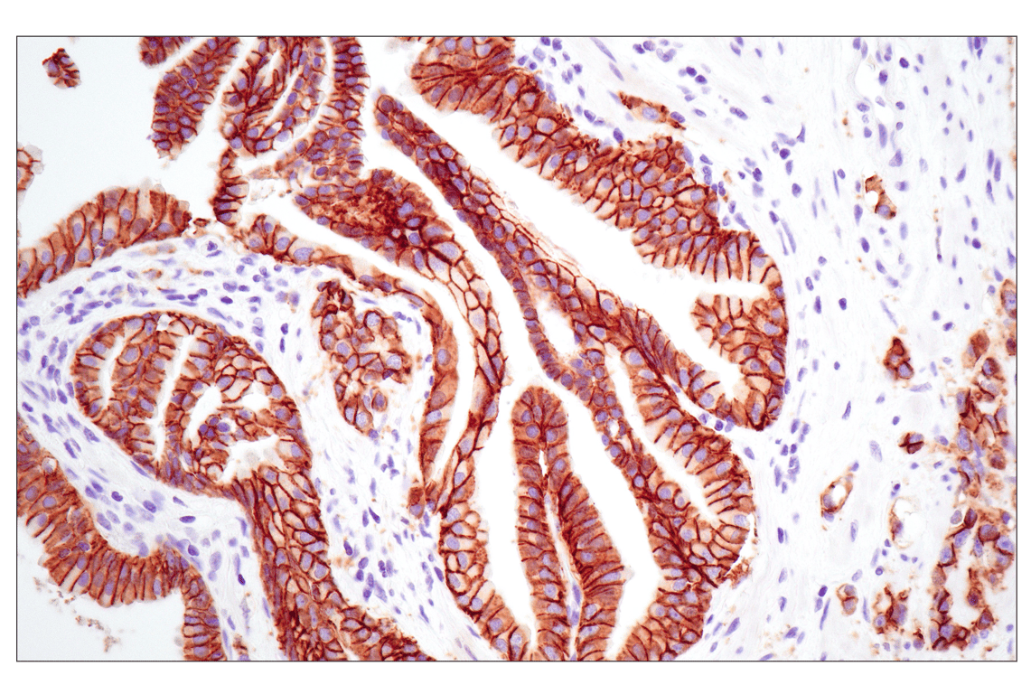 Immunohistochemistry Image 1: E-Cadherin (24E10) Rabbit Monoclonal Antibody