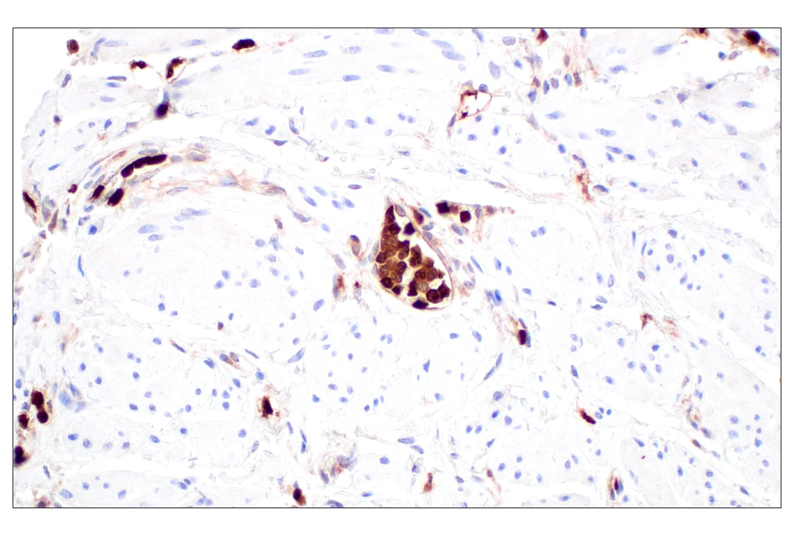 Immunohistochemistry Image 4: SerpinB1 (E4W7B) Rabbit Monoclonal Antibody (BSA and Azide Free)