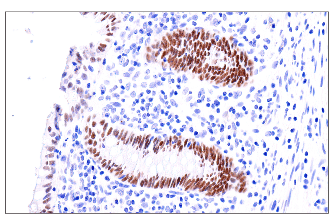 Immunohistochemistry Image 14: GATA-6 (D61E4) XP<sup>®</sup> Rabbit mAb (BSA and Azide Free)