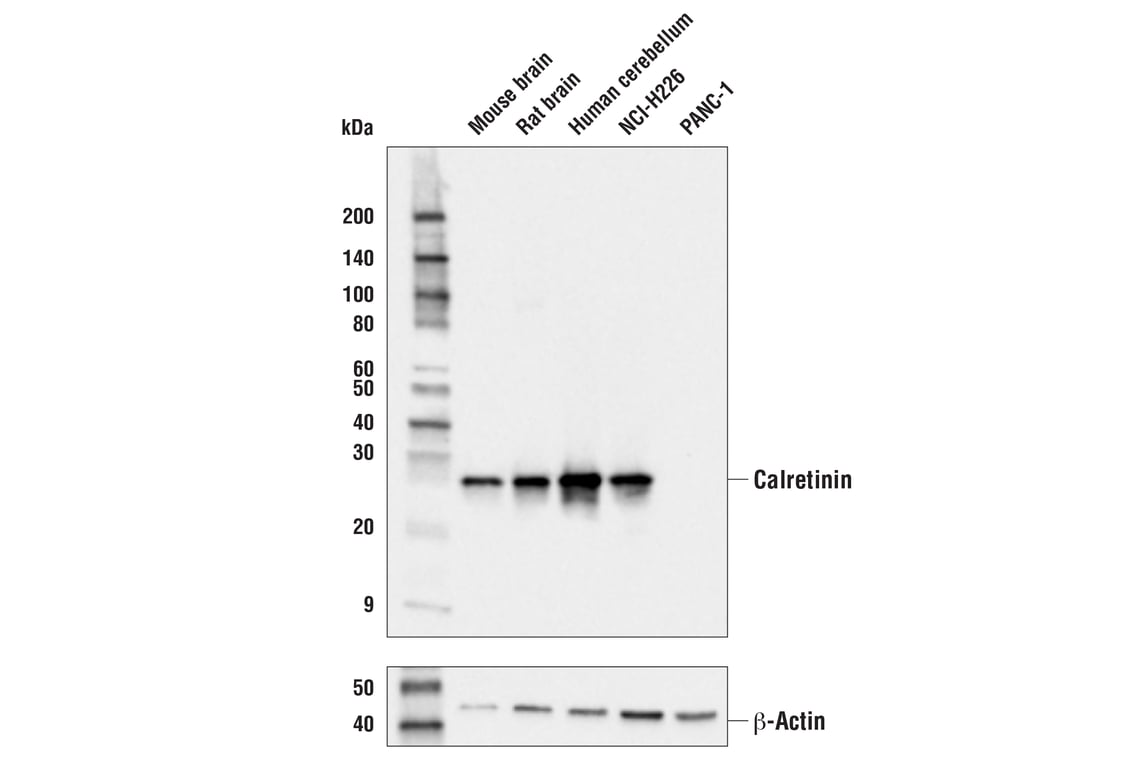 Western Blotting Image 1: Calretinin (E7R6O) XP<sup>®</sup> Rabbit mAb (BSA and Azide Free)
