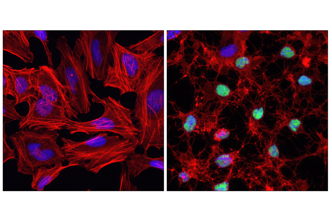 undefined Image 19: Human Reactive Cell Death and Autophagy Antibody Sampler Kit