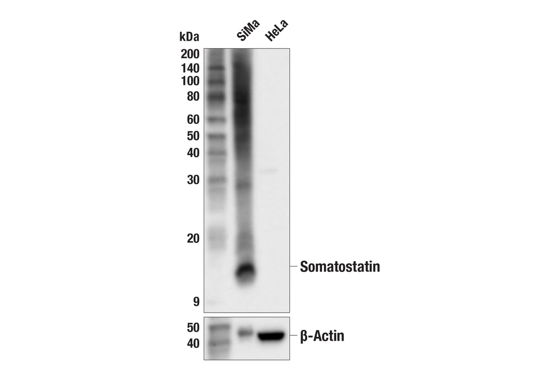 Western Blotting Image 2: Somatostatin (F8W1R) Rabbit Monoclonal Antibody