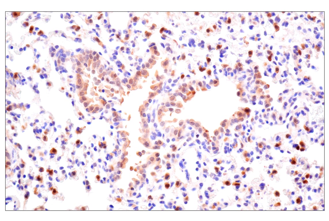 Immunohistochemistry Image 11: ACBP/DBI (E4V8V) Rabbit Monoclonal Antibody