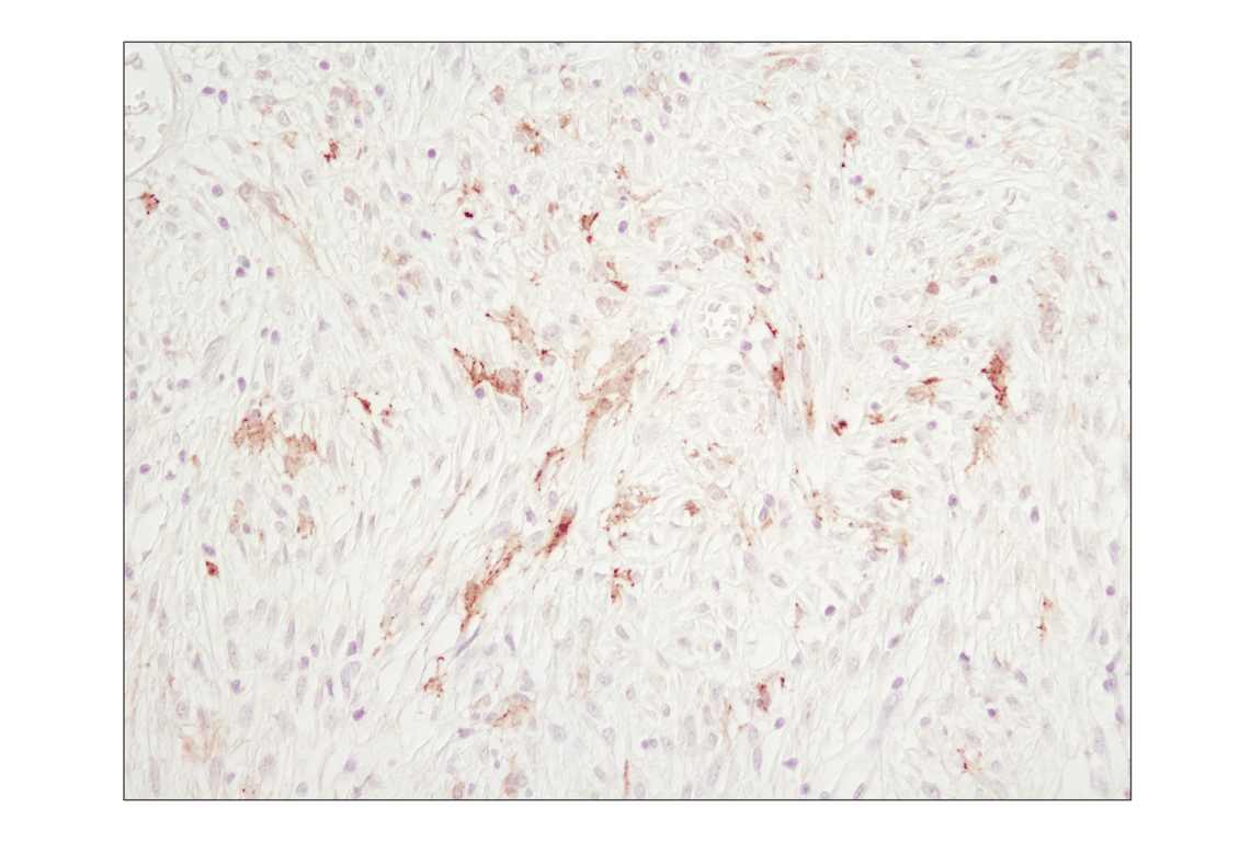 Immunohistochemistry Image 3: Cleaved Caspase-3 (Asp175) (D3E9) Rabbit Monoclonal Antibody (BSA and Azide Free)