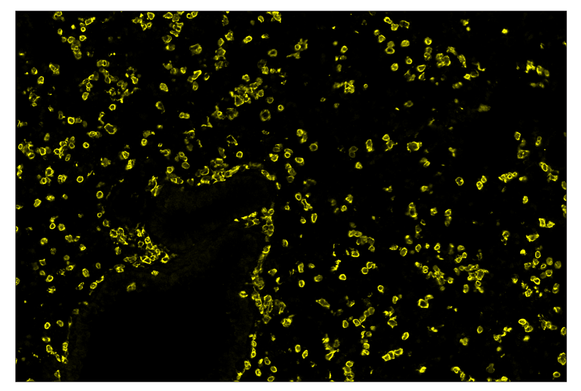 Immunohistochemistry Image 3: CD45 (D3F8Q) & CO-0046-750 SignalStar<sup>™</sup> Oligo-Antibody Pair