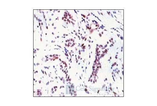 Phospho-Erk1/2 Pathway Antibody Sampler Kit | Cell Signaling