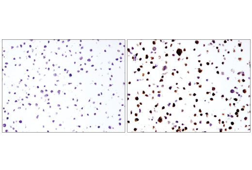 Immunohistochemistry Image 3: IL-1 beta (3A6) Mouse Monoclonal Antibody (BSA and Azide Free)