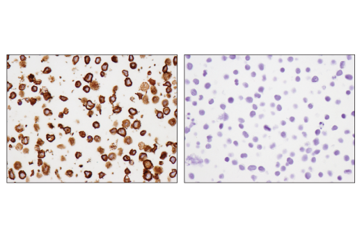 Immunohistochemistry Image 4: CD79B (D7V2F) Rabbit Monoclonal Antibody (BSA and Azide Free)