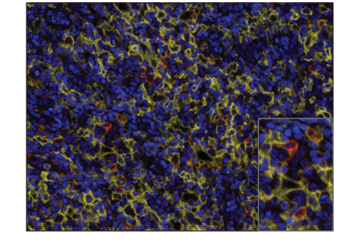 Immunohistochemistry Image 1: XCR1 (D2F8T) Rabbit Monoclonal Antibody