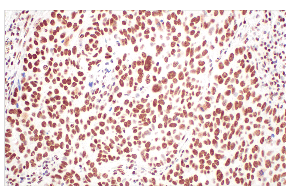 Immunohistochemistry Image 2: CBX7 (E7N1W) Rabbit Monoclonal Antibody